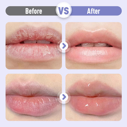 Plumping & Anti-Wrinkle Hydrating Lip Serum